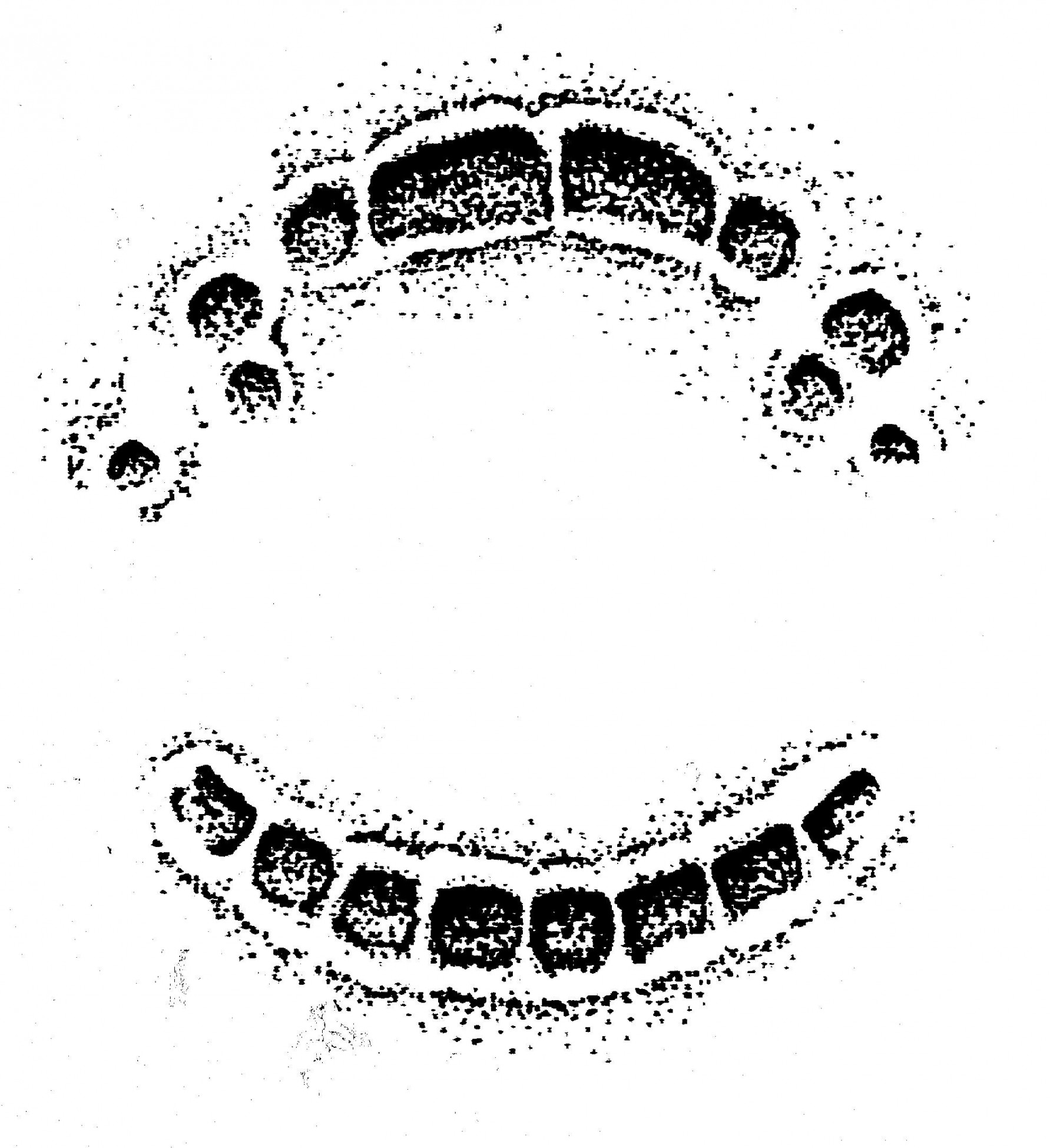 bite marks - Google-søgning  Tooth and claw, Ink, Drawings